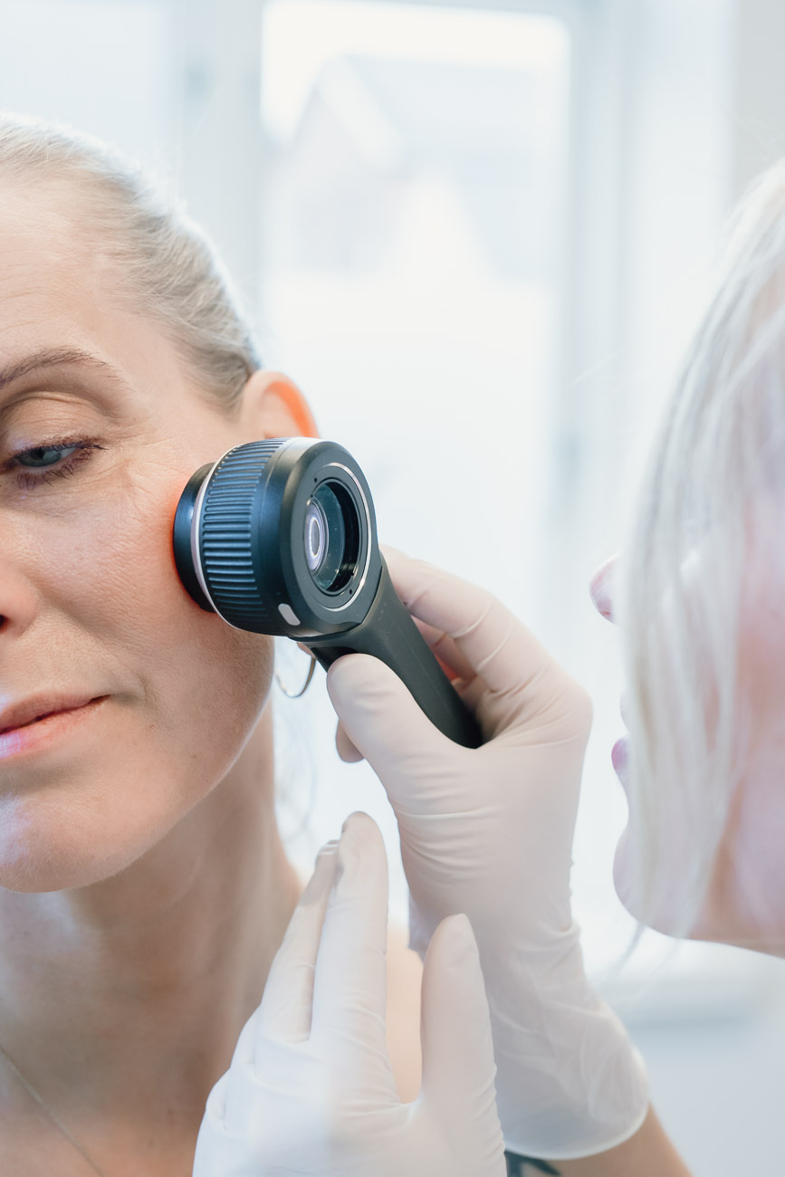 få tjekket modermærker