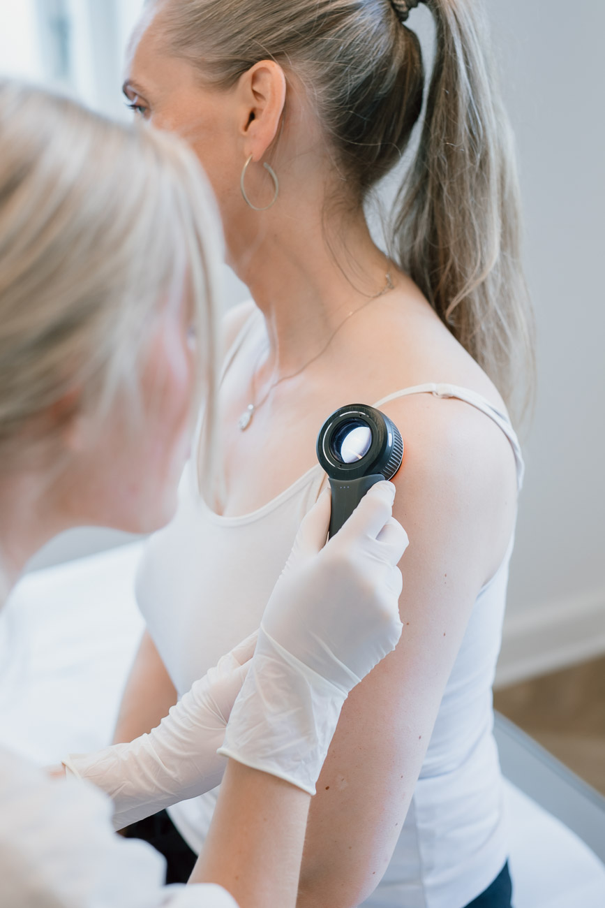 tjek af modermærker