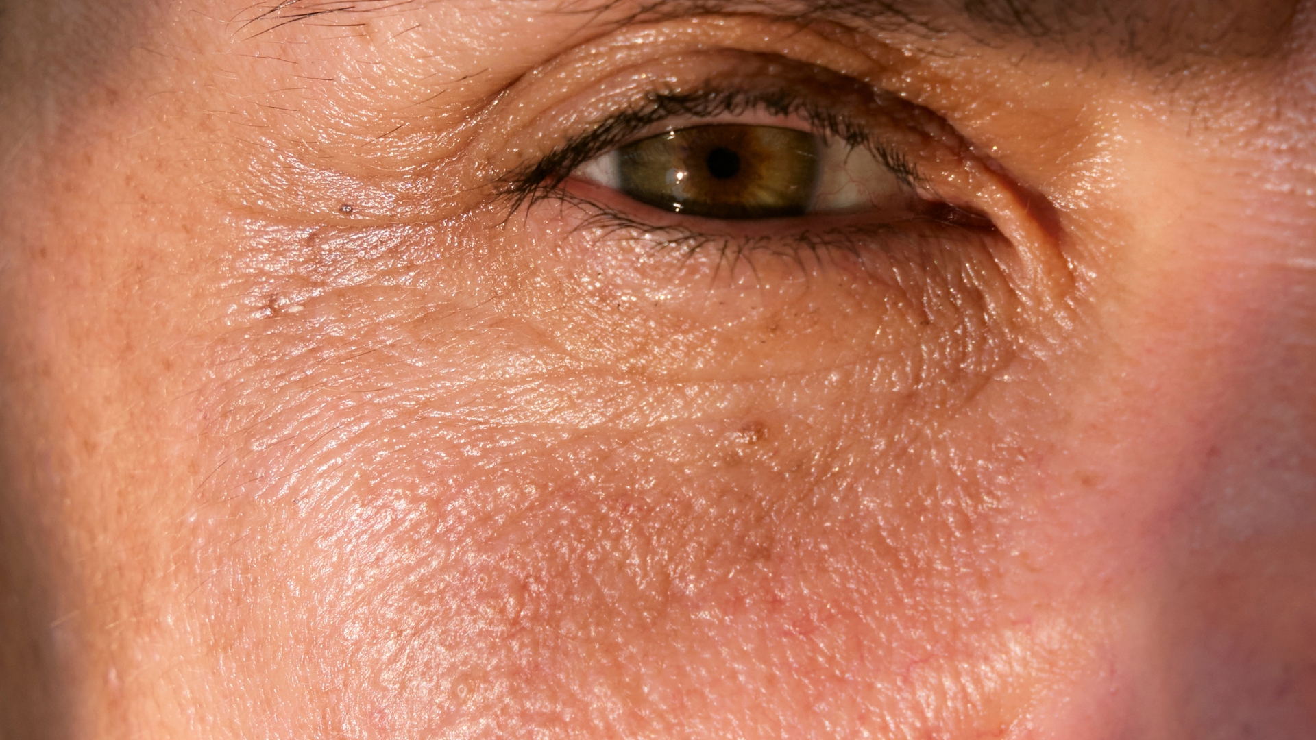 kollagen i huden rynker og fine linjer